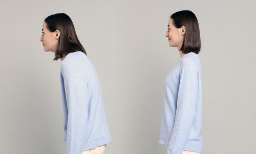 猫背で起きる変化