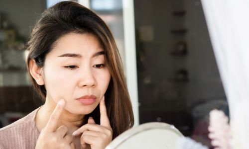 影(目の下・ほうれい線・フェイスライン)が強調されやすいイメージ